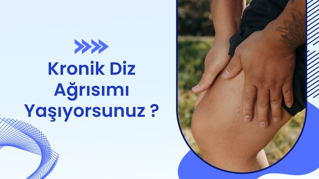Diz Bölgesi
